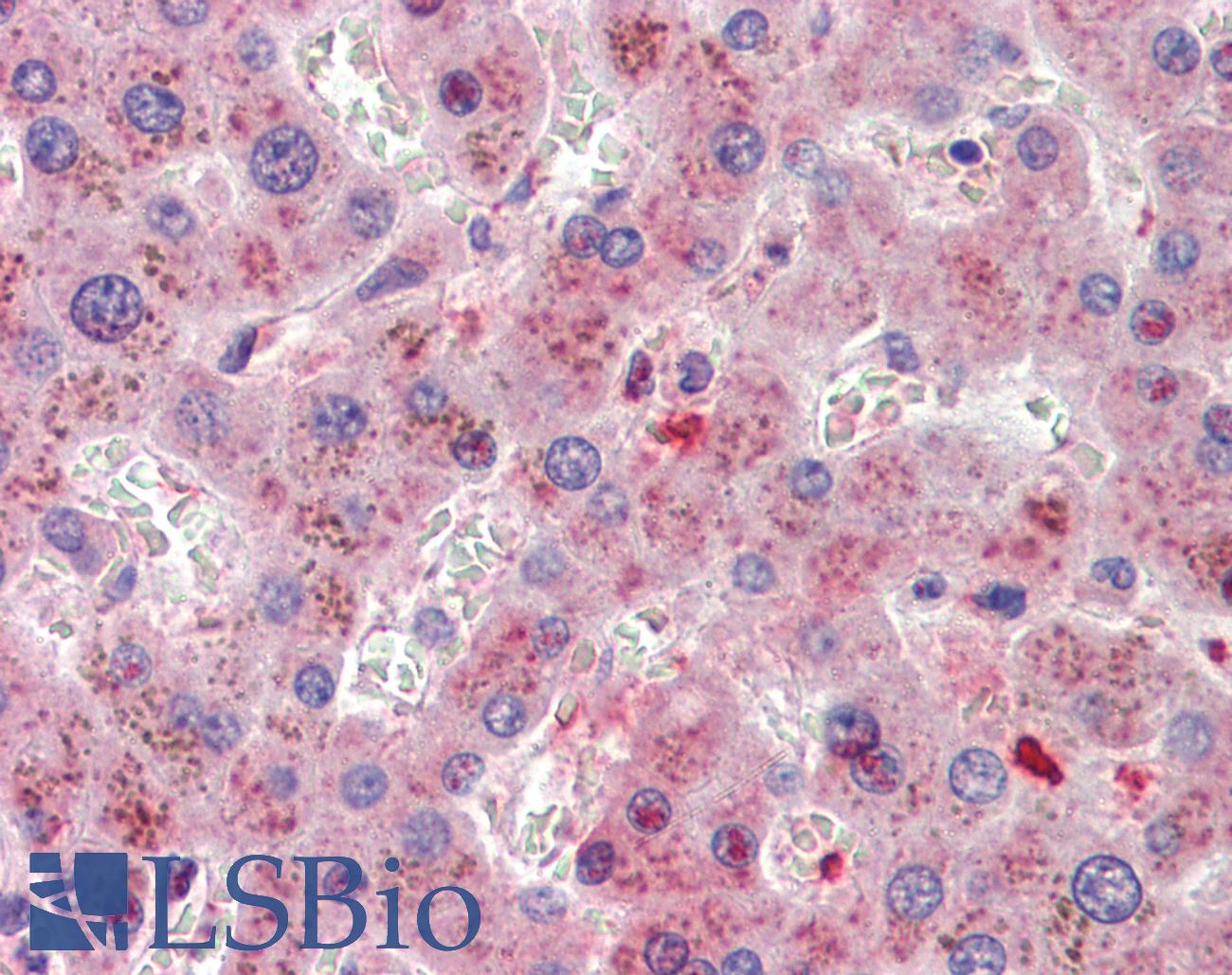 5-Alpha Reductase / SRD5A1 Antibody - Anti-SRD5A1 antibody IHC of human liver. Immunohistochemistry of formalin-fixed, paraffin-embedded tissue after heat-induced antigen retrieval. Antibody concentration 3.75 ug/ml.