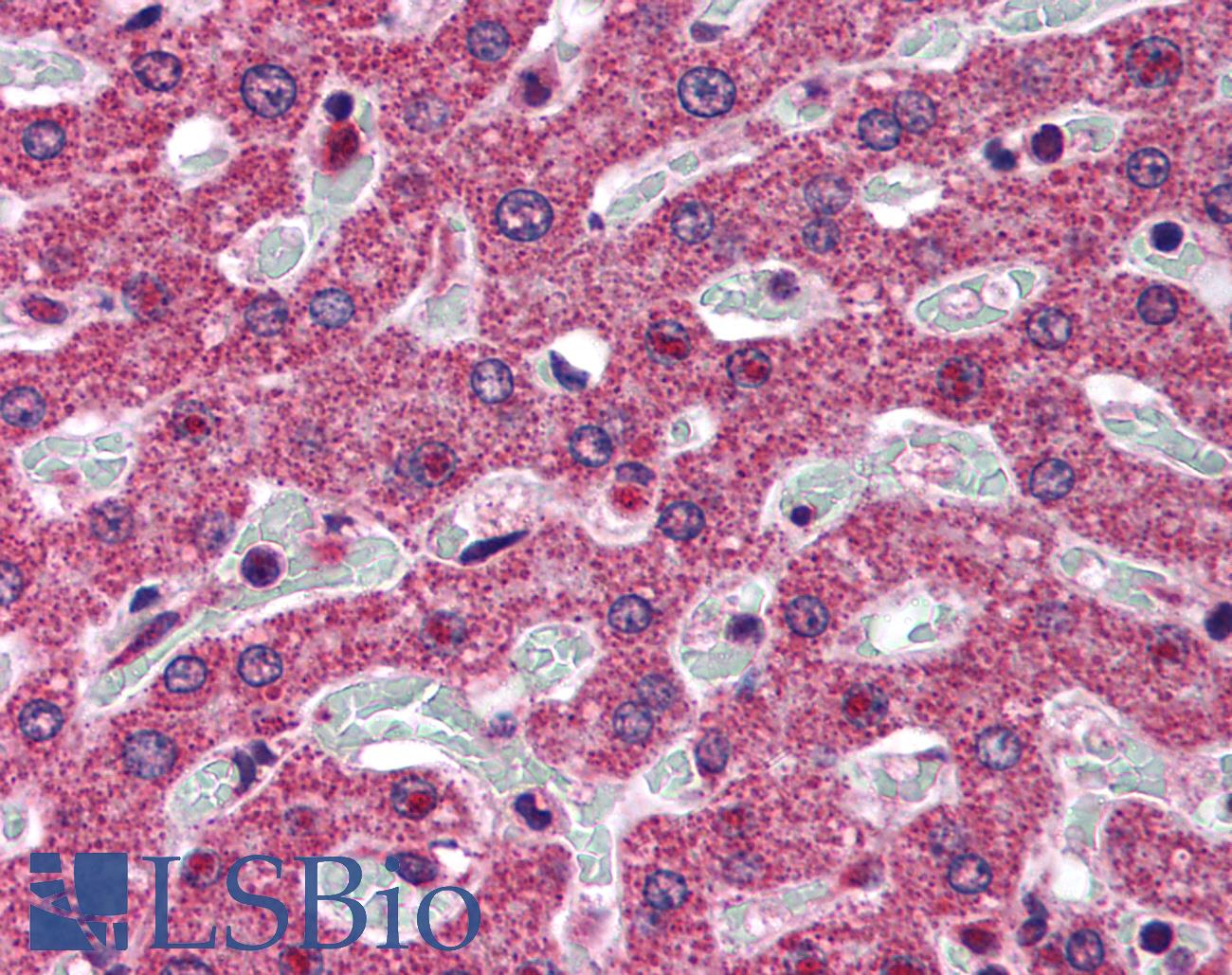 5-Alpha Reductase / SRD5A1 Antibody - Anti-SRD5A1 antibody IHC of human liver. Immunohistochemistry of formalin-fixed, paraffin-embedded tissue after heat-induced antigen retrieval. Antibody concentration 5 ug/ml.