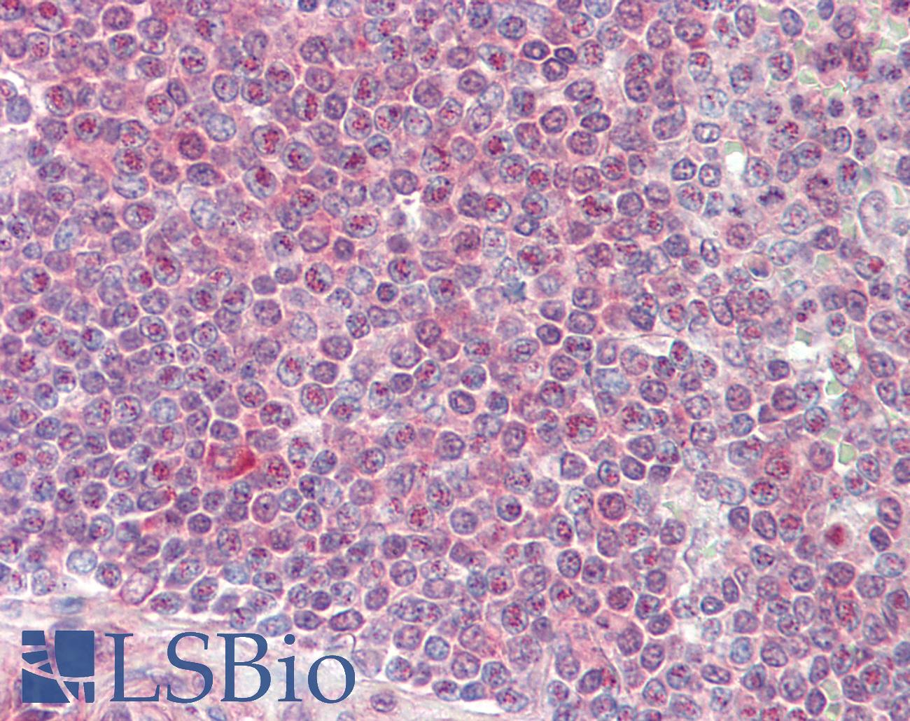 A1CF / ACF Antibody - Anti-A1CF / ACF antibody IHC staining of human spleen. Immunohistochemistry of formalin-fixed, paraffin-embedded tissue after heat-induced antigen retrieval.