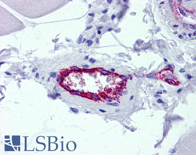 AAAS / Adracalin Antibody - Anti-AAAS / Adracalin antibody IHC of human skeletal muscle, vessel. Immunohistochemistry of formalin-fixed, paraffin-embedded tissue after heat-induced antigen retrieval. Antibody concentration 5 ug/ml.
