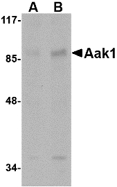 AAK1 Antibody - Western blot of Aak1 in A-20 lysate with Aak1 antibody at (A) 1 and (B) 2 ug/ml.
