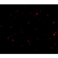 AAK1 Antibody - Immunofluorescence of aak1 in human brain tissue with aak1 antibody at 20 µg/mL.