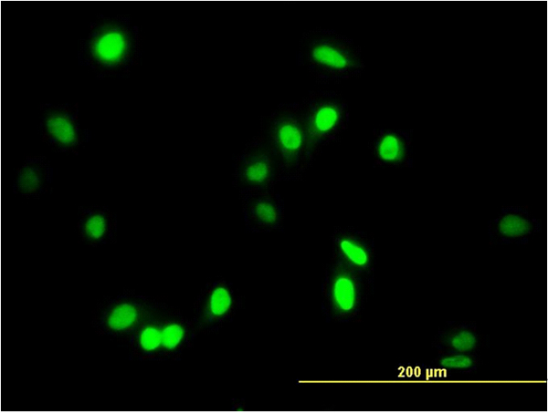 AATF Antibody - Immunofluorescence of monoclonal antibody to AATF on HeLa cell. [antibody concentration 10 ug/ml]