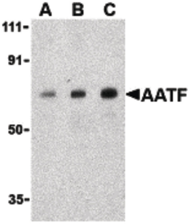AATF Antibody - Western blot of AATF in human small intestine cell lysate with AATF antibody at (A) 0.5, (B) 1 and (C) 2 ug/ml.