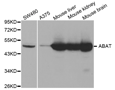 ABAT Antibody - Western blot analysis of extracts of various cell lines, using ABAT antibody.