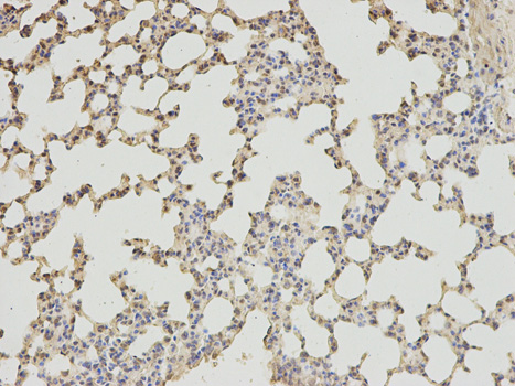ABAT Antibody - Immunohistochemistry of paraffin-embedded mouse lung using ABAT antibody at dilution of 1:200 (200x lens).
