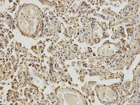 ABAT Antibody - Immunohistochemistry of paraffin-embedded human lung using ABAT antibody at dilution of 1:200 (200x lens).