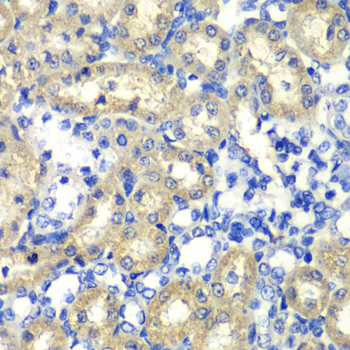 ABAT Antibody - Immunohistochemistry of paraffin-embedded rat kidney tissue.
