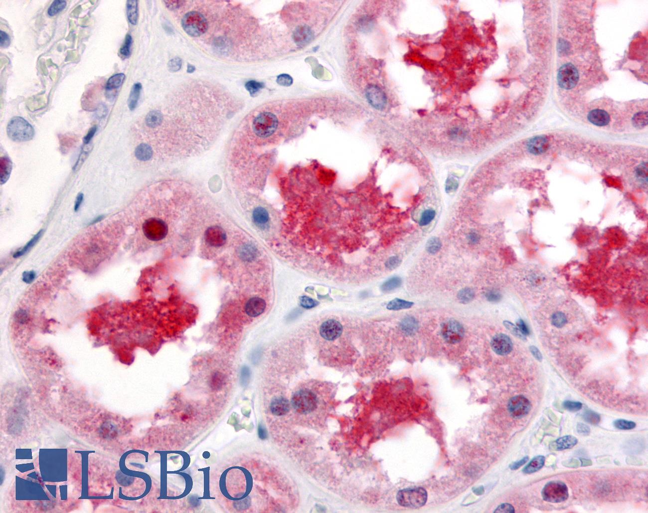 ABCB1 / MDR1 / P Glycoprotein Antibody - Anti-ABCB1 / MDR1 antibody IHC of human kidney, proximal convoluted tubules. Immunohistochemistry of formalin-fixed, paraffin-embedded tissue after heat-induced antigen retrieval.