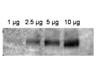 ABCB1 / MDR1 / P Glycoprotein Antibody - Anti-ABCB1 Antibody - Western Blot. Western blot of affinity purified anti-ABCB1 antibody shows detection of ABCB1 in crude membrane extracts from HF insect cells over-expressing human ABCB1. The extract was loaded onto a gel in the amounts indicated followed by electrophoresis and transfer to nitrocellulose. The membrane was probed with the primary antibody diluted to 1:600, followed by Peroxidase Conjugated Affinity Purified Anti-RABBIT IgG at 1:10000. Personal Communication, Anna Calcagno, CCR-NCI, Bethesda, MD.