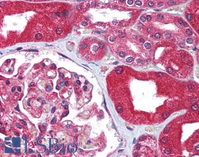 ABCB1 / MDR1 / P Glycoprotein Antibody - Anti-MDR1 antibody IHC of human kidney. Immunohistochemistry of formalin-fixed, paraffin-embedded tissue after heat-induced antigen retrieval. Antibody concentration 5 ug/ml.