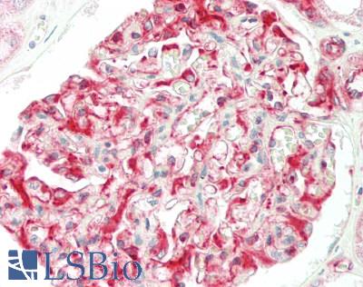 ABCB10 Antibody - Human Kidney: Formalin-Fixed, Paraffin-Embedded (FFPE)