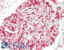 ABCB10 Antibody - Human Kidney: Formalin-Fixed, Paraffin-Embedded (FFPE)