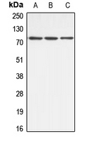 ABCB10 Antibody - Western blot analysis of ABCB10 expression in HeLa (A); mouse kidney (B); rat kidney (C) whole cell lysates.