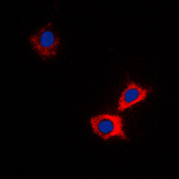 ABCB10 Antibody - Immunofluorescent analysis of ABCB10 staining in HeLa cells. Formalin-fixed cells were permeabilized with 0.1% Triton X-100 in TBS for 5-10 minutes and blocked with 3% BSA-PBS for 30 minutes at room temperature. Cells were probed with the primary antibody in 3% BSA-PBS and incubated overnight at 4 C in a humidified chamber. Cells were washed with PBST and incubated with a DyLight 594-conjugated secondary antibody (red) in PBS at room temperature in the dark. DAPI was used to stain the cell nuclei (blue).