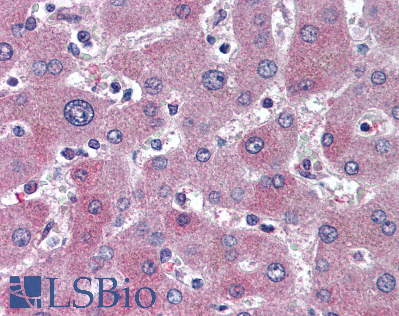 ABCB11 / BSEP Antibody - Anti-ABCB11 / BSEP antibody IHC of human liver. Immunohistochemistry of formalin-fixed, paraffin-embedded tissue after heat-induced antigen retrieval. Antibody concentration 5 ug/ml.