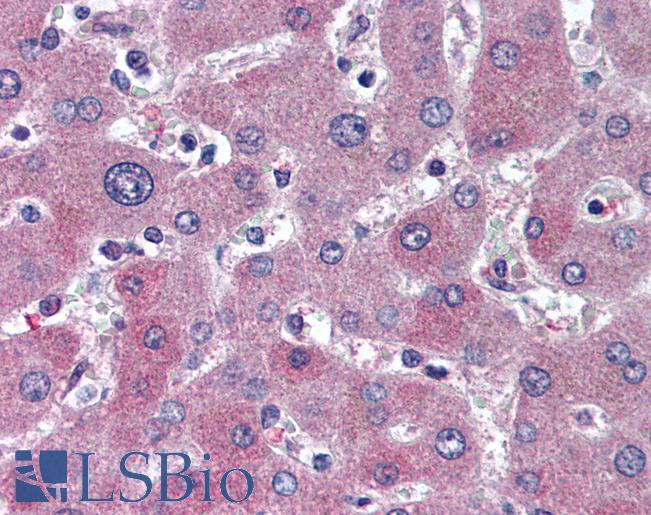 ABCB11 / BSEP Antibody - Anti-ABCB11 / BSEP antibody IHC of human liver. Immunohistochemistry of formalin-fixed, paraffin-embedded tissue after heat-induced antigen retrieval. Antibody concentration 5 ug/ml.