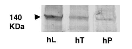 ABCB11 / BSEP Antibody - Western blot of crude membranes isolated from human liver (hL), human.