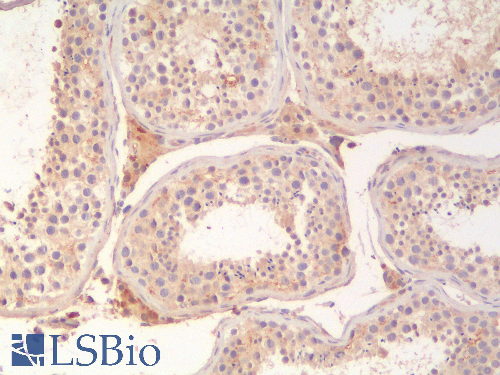 ABCB11 / BSEP Antibody - Human Testis: Formalin-Fixed, Paraffin-Embedded (FFPE)