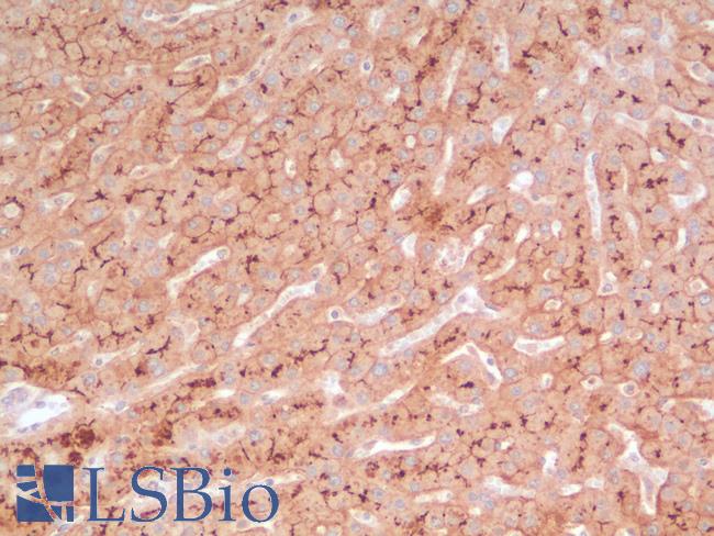 ABCB11 / BSEP Antibody - Human Liver: Formalin-Fixed, Paraffin-Embedded (FFPE)