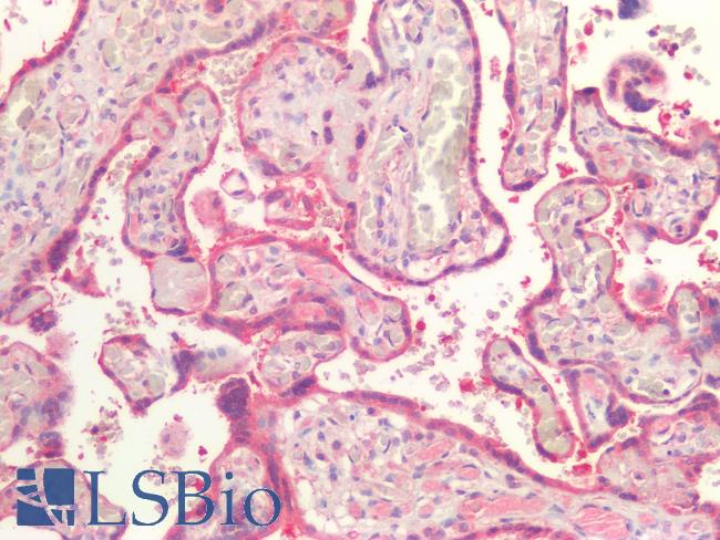 ABCB4 / MDR3 Antibody - Human Placenta: Formalin-Fixed, Paraffin-Embedded (FFPE)