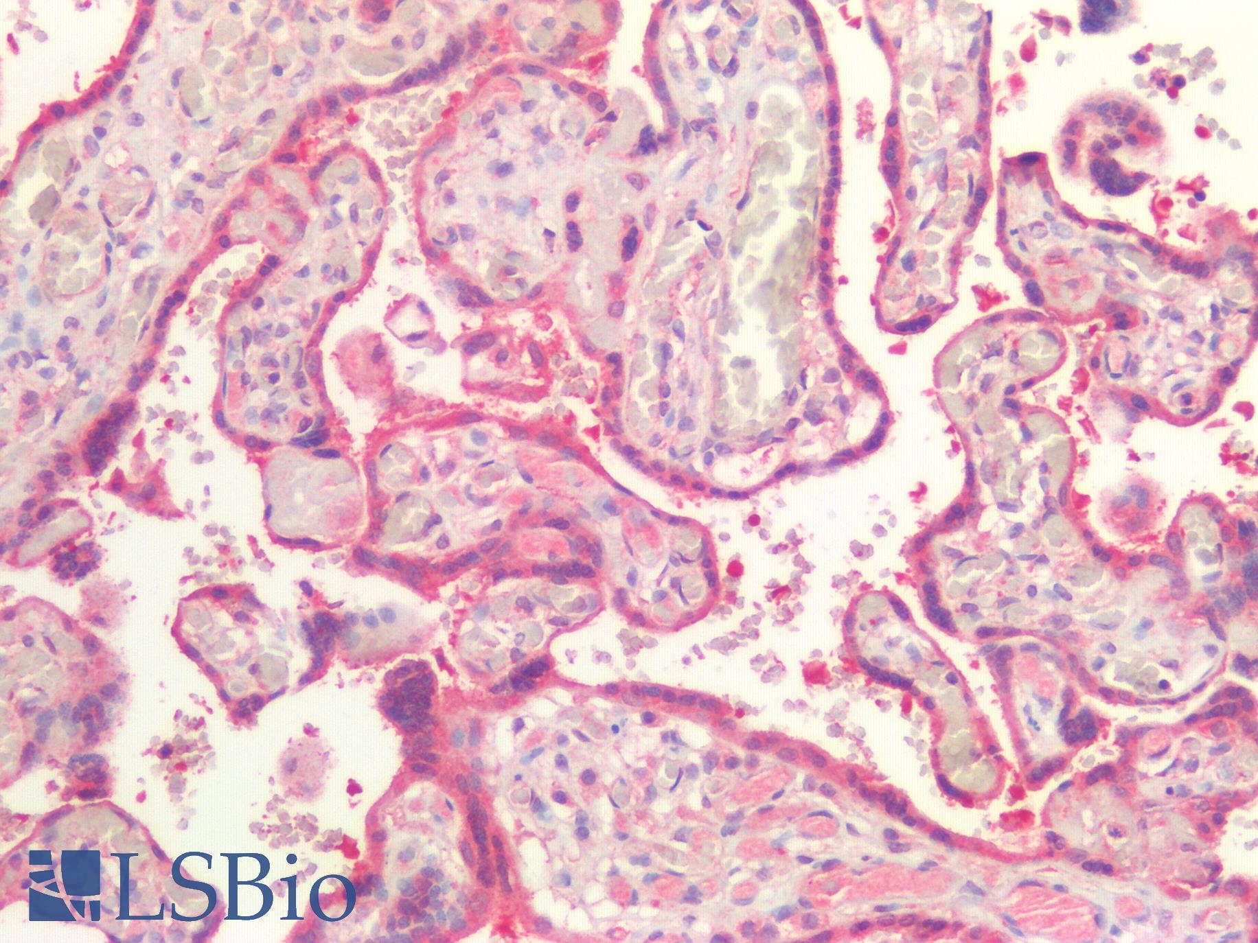 ABCB4 / MDR3 Antibody - Human Placenta: Formalin-Fixed, Paraffin-Embedded (FFPE)