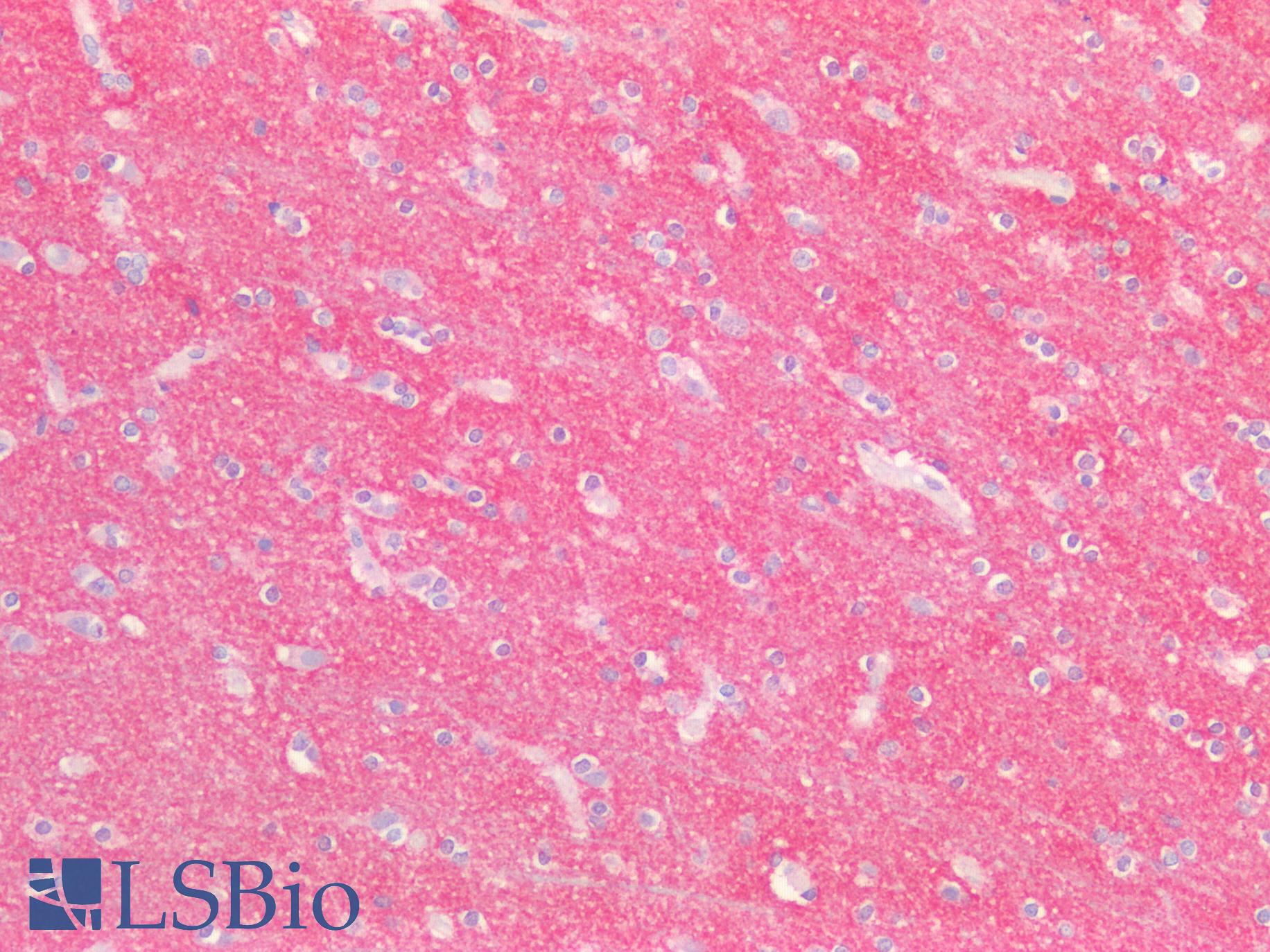 ABCB4 / MDR3 Antibody - Human Brain, Cortex: Formalin-Fixed, Paraffin-Embedded (FFPE)