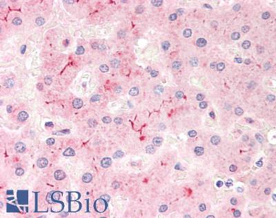 ABCB4 / MDR3 Antibody - Human Liver: Formalin-Fixed, Paraffin-Embedded (FFPE)