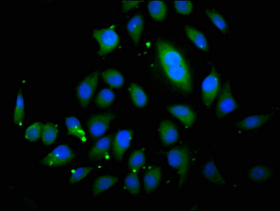 ABCB4 / MDR3 Antibody - Immunofluorescence staining of A549 cells with ABCB4 Antibody at 1:200, counter-stained with DAPI. The cells were fixed in 4% formaldehyde, permeabilized using 0.2% Triton X-100 and blocked in 10% normal Goat Serum. The cells were then incubated with the antibody overnight at 4°C. The secondary antibody was Alexa Fluor 488-congugated AffiniPure Goat Anti-Rabbit IgG(H+L).
