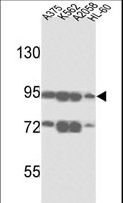 ABCB5 Antibody - Western blot of ABCB5 Antibody in A375, K562, A2058 and HL-60 cell line lysates (35 ug/lane). ABCB5 (arrow) was detected using the purified antibody.
