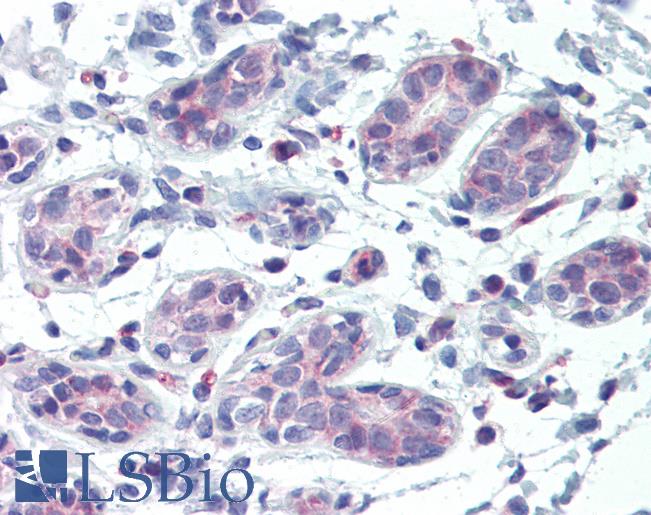 ABCB5 Antibody - Anti-ABCB5 antibody IHC of human breast. Immunohistochemistry of formalin-fixed, paraffin-embedded tissue after heat-induced antigen retrieval. Antibody concentration 10 ug/ml.