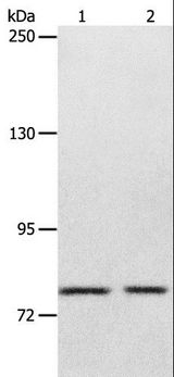ABCB6 Antibody - Western blot analysis of Mouse liver tissue and SP20 cell, using ABCB6 Polyclonal Antibody at dilution of 1:320.