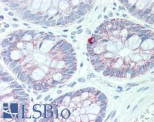 ABCB6 Antibody - Human Colon: Formalin-Fixed, Paraffin-Embedded (FFPE), at dilution of 1:50