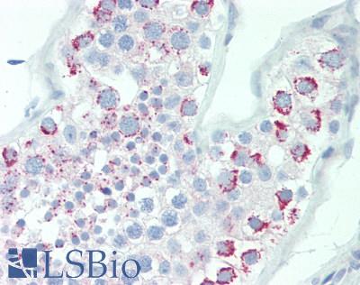ABCB6 Antibody - Human Testis: Formalin-Fixed, Paraffin-Embedded (FFPE), at dilution of 1:50