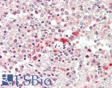 ABCB7 Antibody - Human Spleen: Formalin-Fixed, Paraffin-Embedded (FFPE)