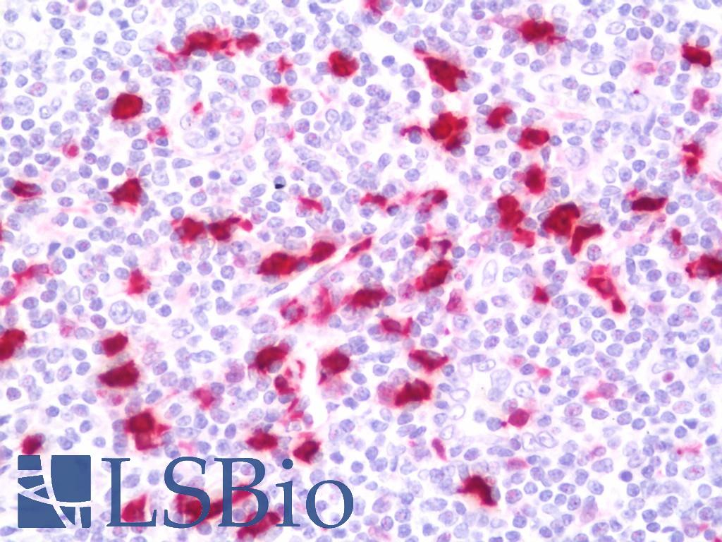 ABCC10 Antibody - Anti-ABCC10 antibody IHC staining of human tonsil. Immunohistochemistry of formalin-fixed, paraffin-embedded tissue after heat-induced antigen retrieval. Antibody dilution 1:50.