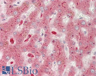 ABCC2 / MRP2 Antibody - Human Liver: Formalin-Fixed, Paraffin-Embedded (FFPE)
