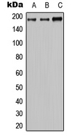 ABCC2 / MRP2 Antibody - Western blot analysis of MRP2 expression in HeLa (A); mouse brain (B); H9C2 (C) whole cell lysates.
