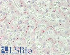 ABCC2 / MRP2 Antibody - Human Liver: Formalin-Fixed, Paraffin-Embedded (FFPE)