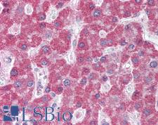 ABCC5 / MRP5 Antibody - Anti-ABCC5 / MRP5 antibody IHC of human liver. Immunohistochemistry of formalin-fixed, paraffin-embedded tissue after heat-induced antigen retrieval. Antibody concentration 5 ug/ml.