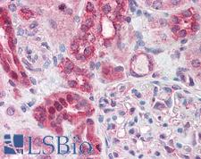 ABCD4 Antibody - Anti-ABCD4 antibody IHC of human kidney. Immunohistochemistry of formalin-fixed, paraffin-embedded tissue after heat-induced antigen retrieval. Antibody concentration 3.75 ug/ml.