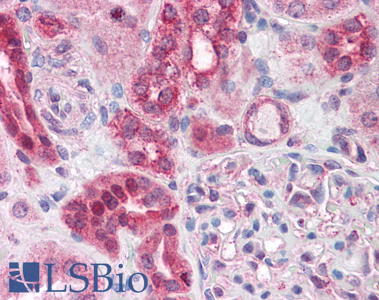ABCD4 Antibody - Anti-ABCD4 antibody IHC of human kidney. Immunohistochemistry of formalin-fixed, paraffin-embedded tissue after heat-induced antigen retrieval. Antibody concentration 3.75 ug/ml.
