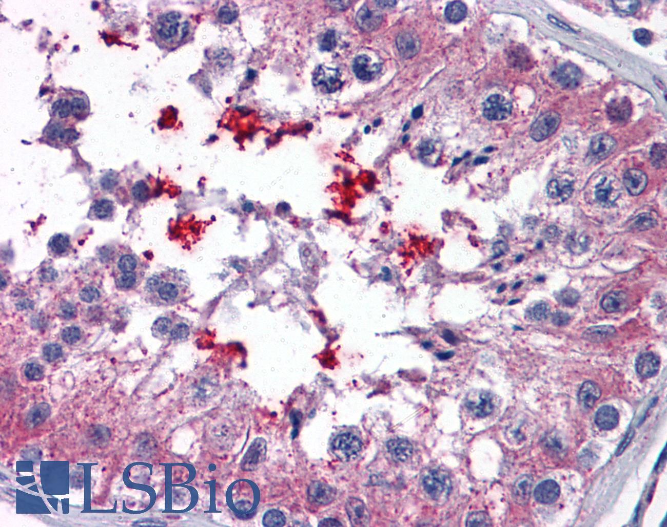 ABCD4 Antibody - Anti-ABCD4 antibody IHC of human testis. Immunohistochemistry of formalin-fixed, paraffin-embedded tissue after heat-induced antigen retrieval. Antibody concentration 3.75 ug/ml.
