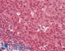 ABCG8 Antibody - Human Tonsil: Formalin-Fixed, Paraffin-Embedded (FFPE)