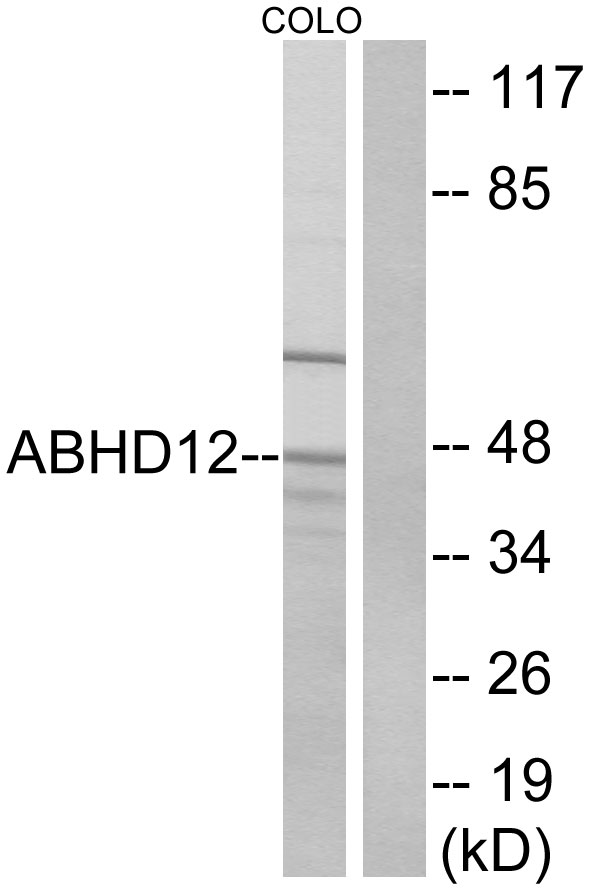 ABHD12 Antibody - Western blot analysis of lysates from COLO cells, using ABHD12 Antibody. The lane on the right is blocked with the synthesized peptide.