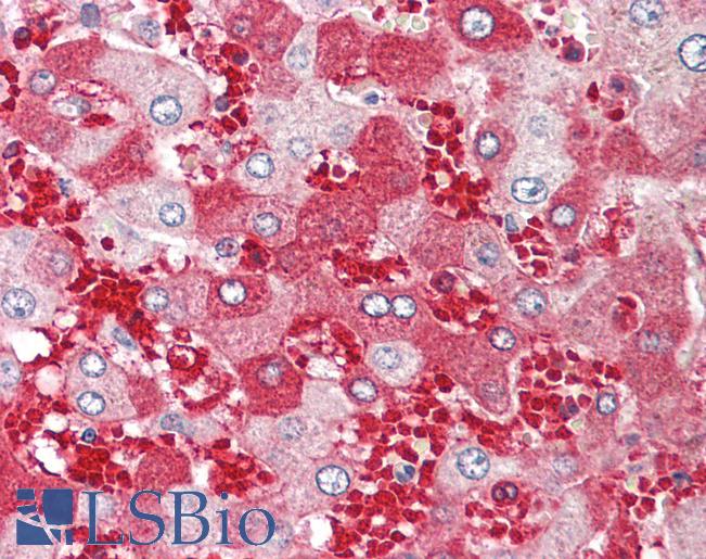 ABHD12B Antibody - Anti-ABHD12B antibody IHC of human liver. Immunohistochemistry of formalin-fixed, paraffin-embedded tissue after heat-induced antigen retrieval. Antibody dilution 5 ug/ml.