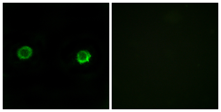 ABHD2 Antibody - Immunofluorescence analysis of MCF-7 cells, using ABHD2 Antibody. The picture on the right is blocked with the synthesized peptide.