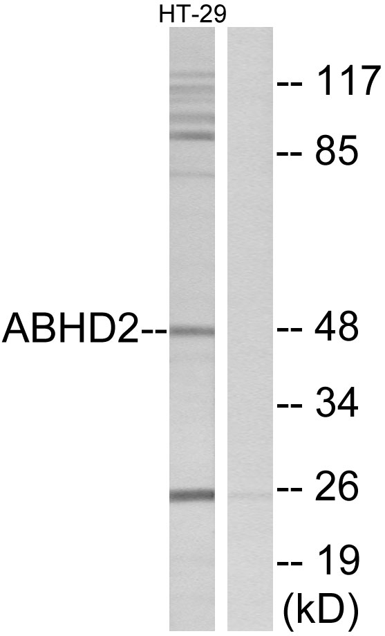 ABHD2 Antibody - Western blot analysis of lysates from HT29 cells, using ABHD2 Antibody. The lane on the right is blocked with the synthesized peptide.