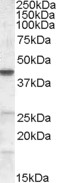 ABHD5 Antibody - ABHD5 (0.2 ug/ml) staining of NIH3T3 lysate (35 ug protein in RIPA buffer). Primary incubation was 1 hour. Detected by chemiluminescence.