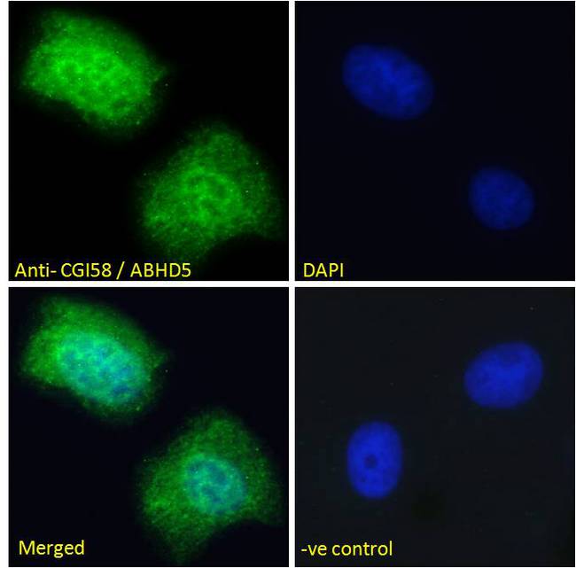 ABHD5 Antibody - CGI58 / ABHD5 antibody immunofluorescence analysis of paraformaldehyde fixed U2OS cells, permeabilized with 0.15% Triton. Primary incubation 1hr (10ug/ml) followed by Alexa Fluor 488 secondary antibody (2ug/ml), showing vesicle staining. The nuclear stain is DAPI (blue).